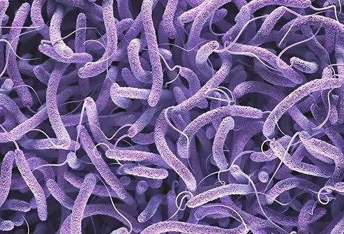 Research-Driven Action Needed to Curb Cholera Spread, Cross River Says